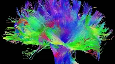 Neurography image of brain