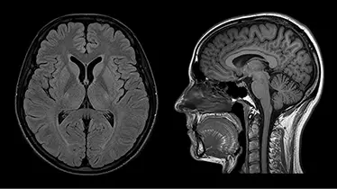 Neurography image of brain and skull