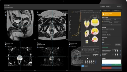 Prostate Reporting: Integrated AI