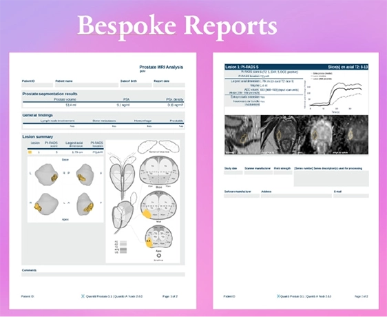 Bespoke Reports